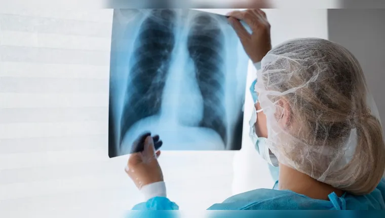 Mais de 10 milhões de pessoas tiveram tuberculose em 2024, diz OMS