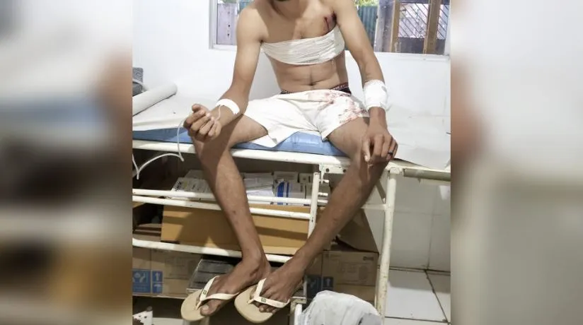 Motociclista é baleado quatro vezes ao se recusar a entregar moto para assaltantes