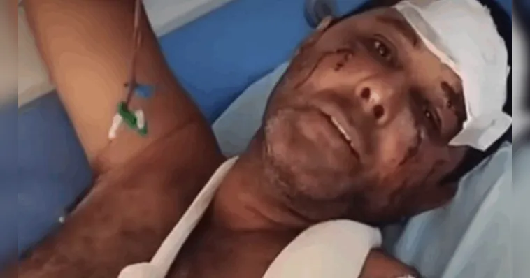 Homem de 51 anos é ferido em ataque raro de onça no interior