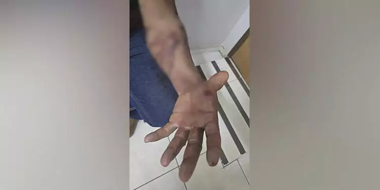 Mulher é presa suspeita de ferir marido e bebê de oito meses em Parauapebas