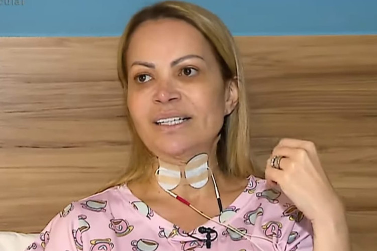 Solange Almeida diz que vício em vape causou lesão nas cordas vocais
