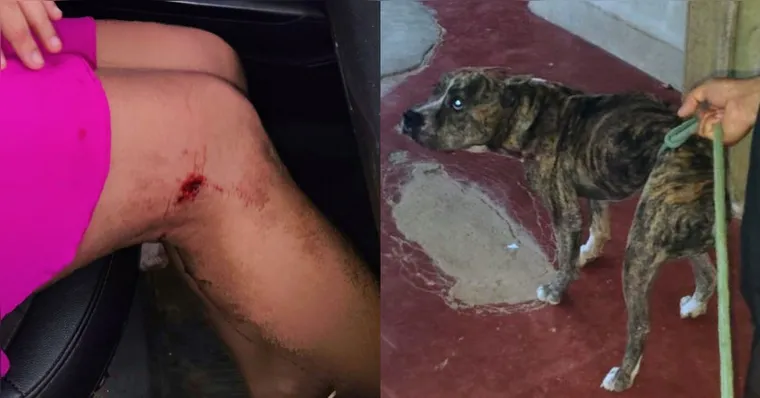 Pitbull ataca mulher e os três filhos dentro de casa em Água Azul do Norte
