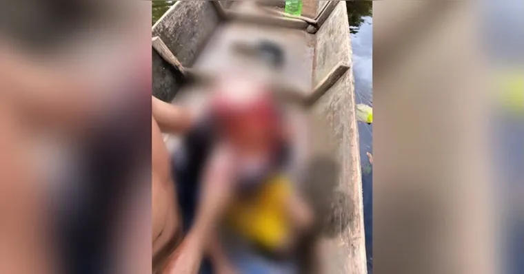 Criança de 7 anos sofre escalpelamento em embarcação em Portel no Marajó